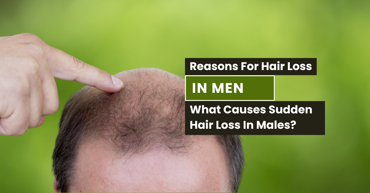 Reasons For Hair Loss In Men