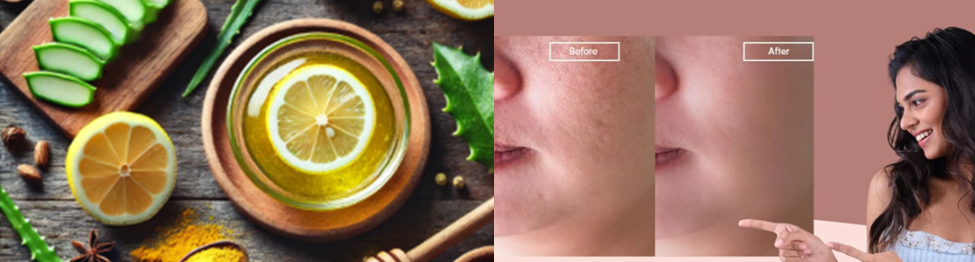  Right Anti-Dandruff Shampoo