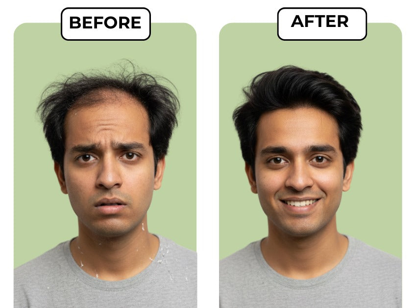 Hair Care Kit for Women and Men| Onion Mist (100ml) + Oil Plus (100ml) + Onion Shampoo (250ml)