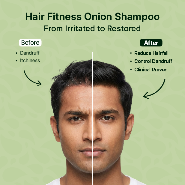 Nature Nuskha Protein Rich Onion Shampoo with Hyaluronic Acid | Supports Hair Growth & Hydration